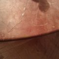 Filled Fixed Fissure On Bulnose Edge Dining Table
